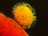    ,        10 ,      (MERS-CoV),        20   