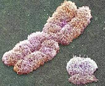 X-  Y-,    euscea.org