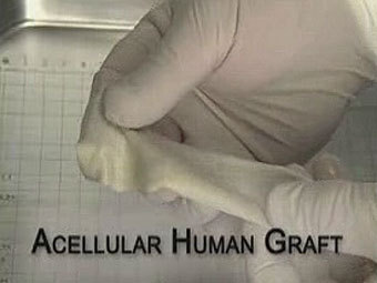   Lifecell.    